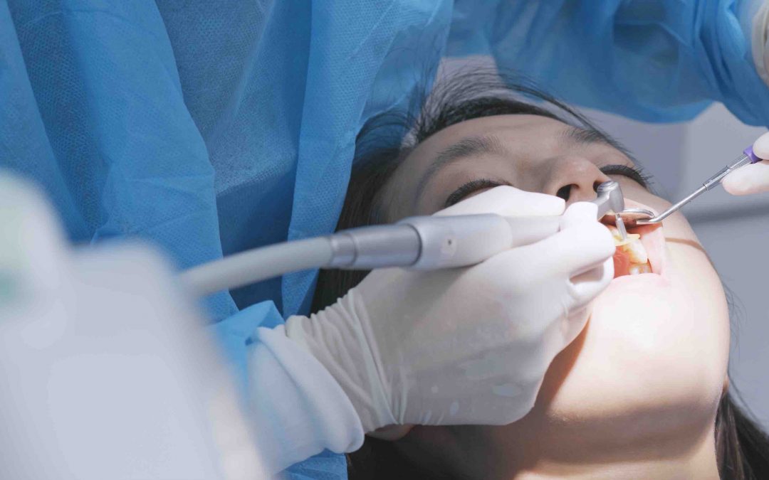 What You Need To Know About Overcoming Dental Fear