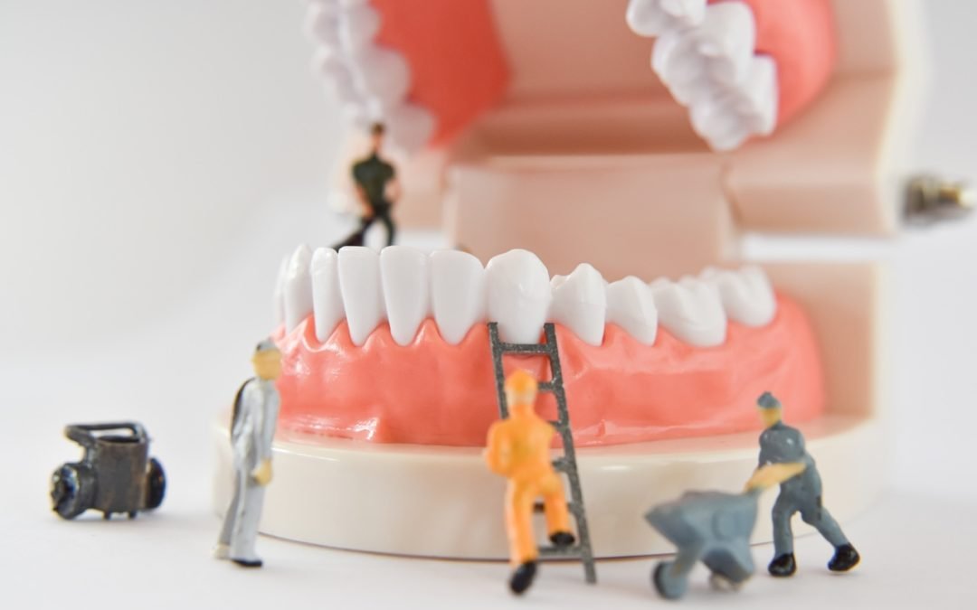 Should You Pull Your Tooth Out Or Save It?