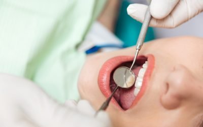 The Link Between Oral Health And Strokes