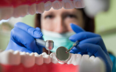 A Patient’s Guide to Managing Post-Dental Implant Bleeding