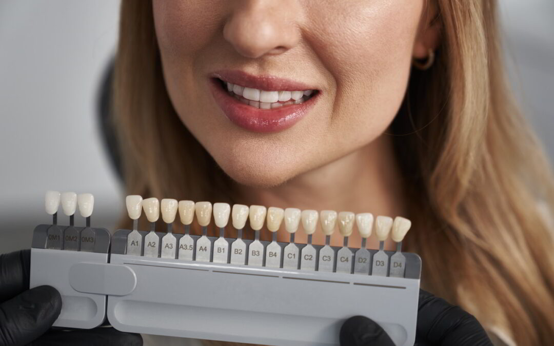 What You Need To Know About Cosmetic Dentistry Treatment